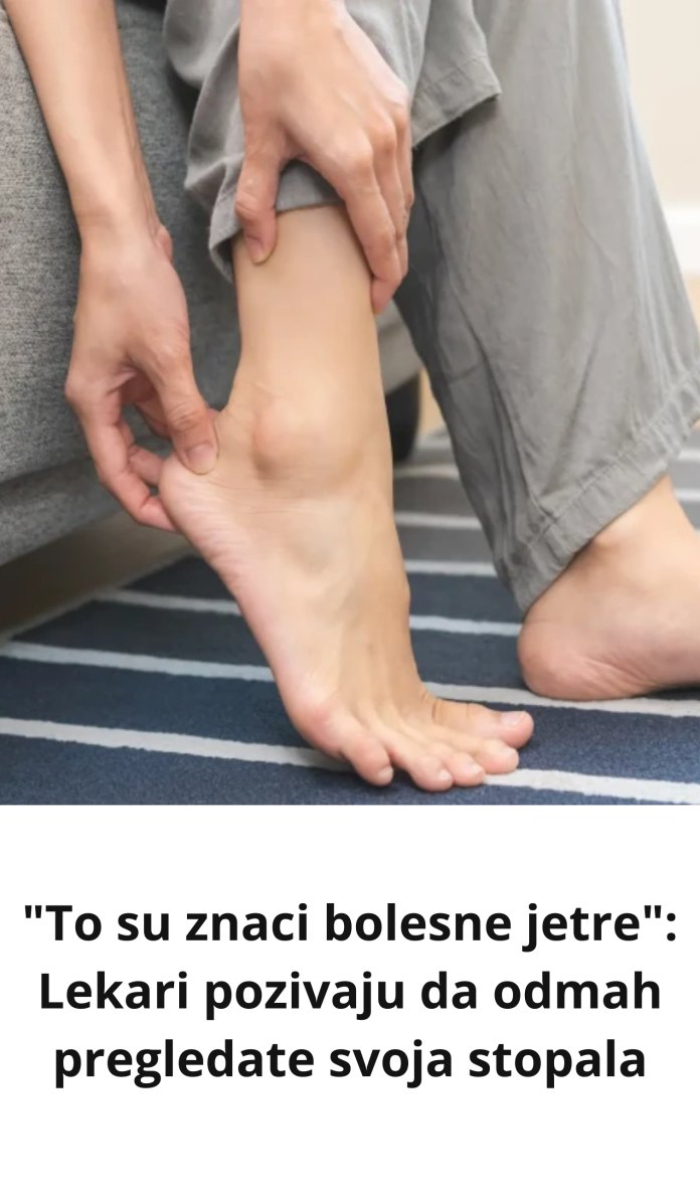 Ovo su znaci bolesne jetre: Odmah pregledate svoja stopala! - featured image Ovo su znaci bolesne jetre: Odmah pregledate svoja stopala! - featured image