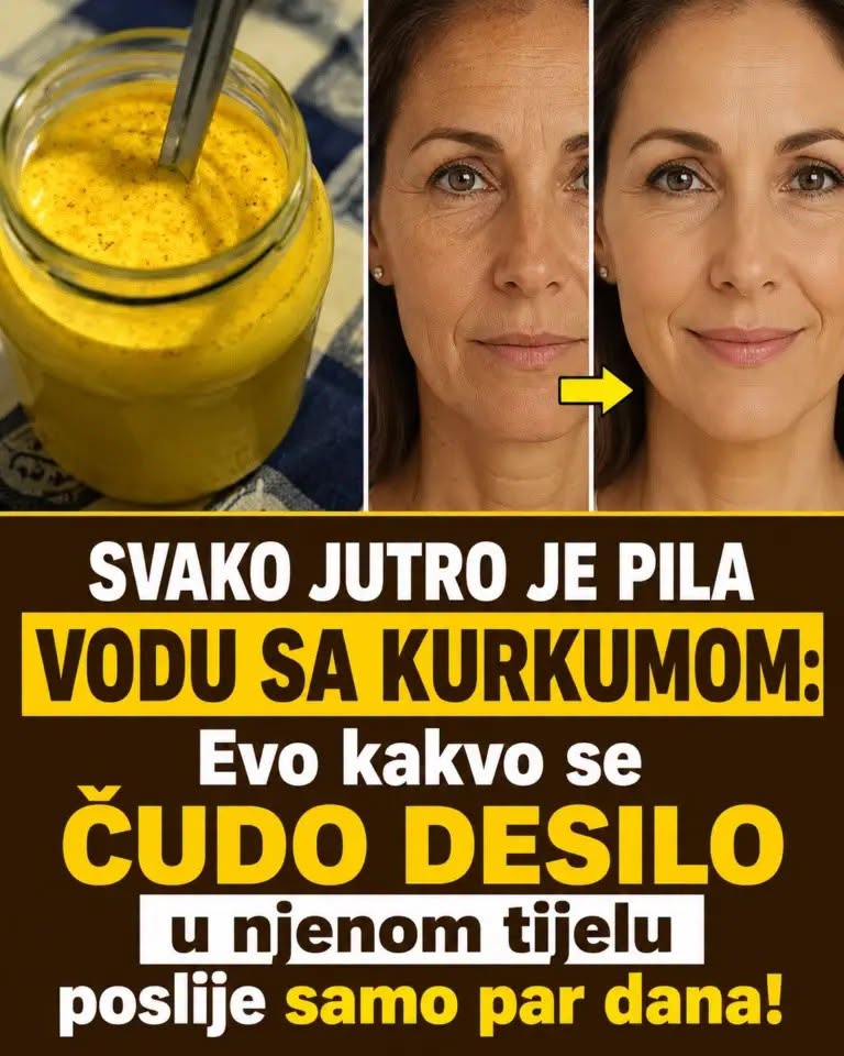 SVAKO JUTRO JE PILA VODU SA KURKUMOM: Evo kakvo se čudo desilo u njenom tijelu poslije samo par dana - featured image SVAKO JUTRO JE PILA VODU SA KURKUMOM: Evo kakvo se čudo desilo u njenom tijelu poslije samo par dana - featured image