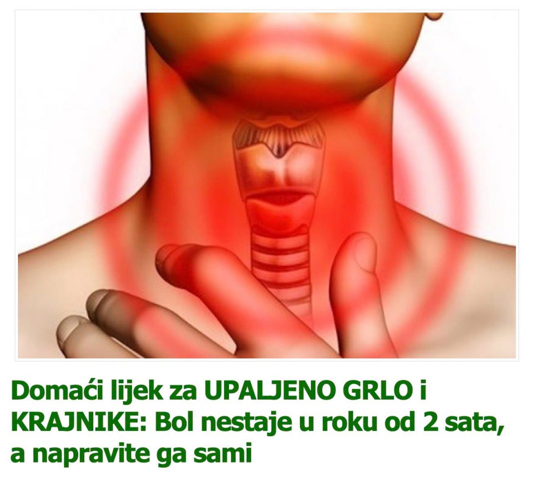 Domaći lijek za UPALJENO GRLO i KRAJNIKE: Bol nestaje u roku od 2 sata, a napravite ga sami - featured image